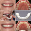 Snap-On Dentures