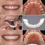 Snap-On Dentures